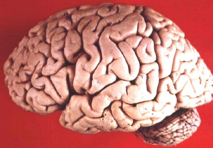 Bestand:Human brain lateral view.jpg