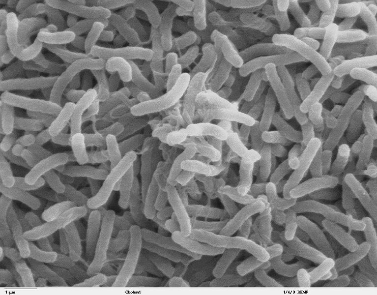 Bestand:767px-Cholera bacteria SEM.jpg