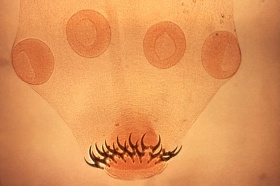 De kop van een varkenslintworm (Taenia solium), met 4 zuigers en 2 rijen met haken.